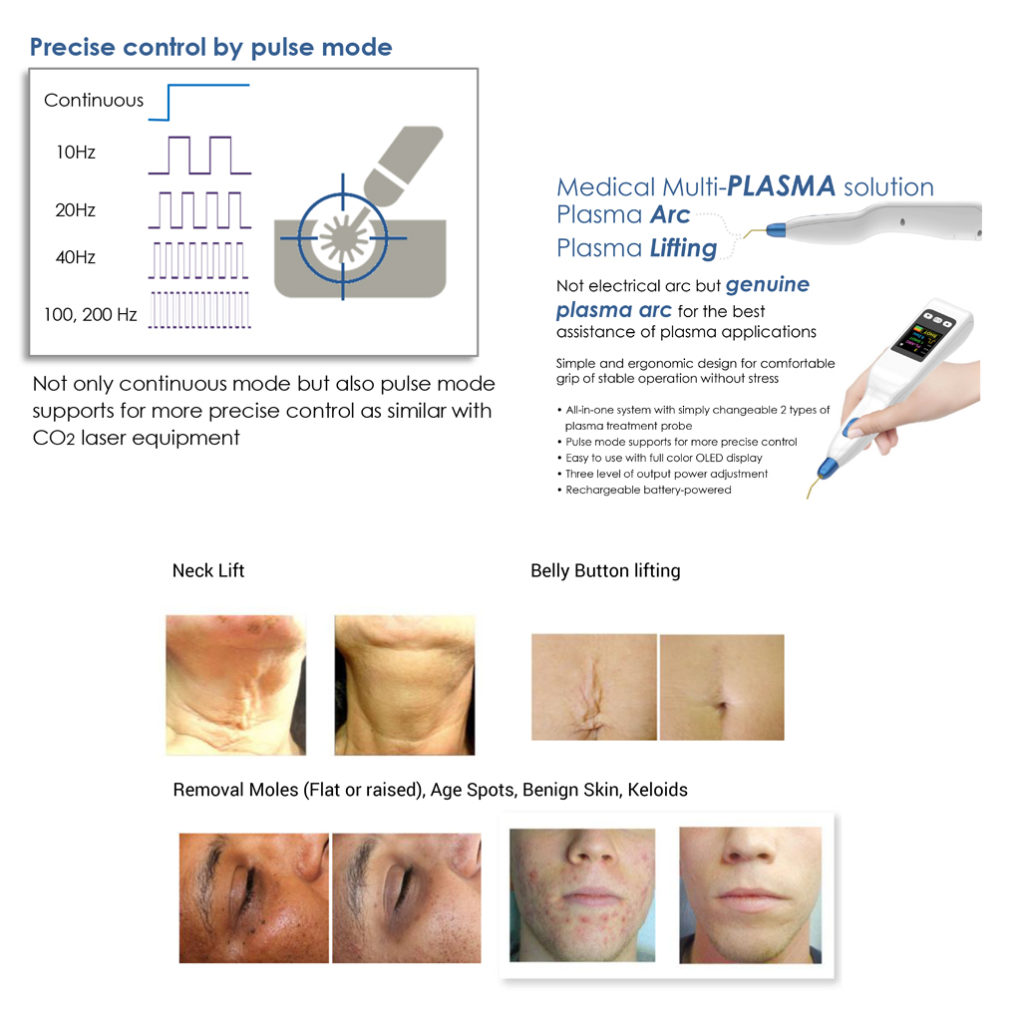 PLAXPOT Plasma Pen Plaxpot Plasma Arc Pen