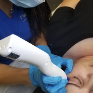 asian eyelid correction