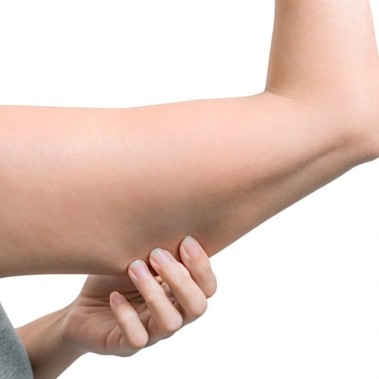 Fat Reduction – Injectables/Mesotherapy