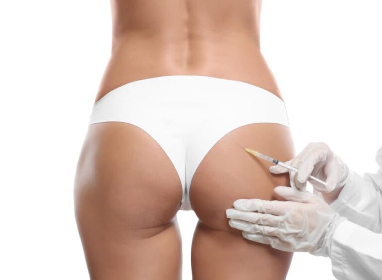 Advanced Dermal Filler Buttock lift Course
