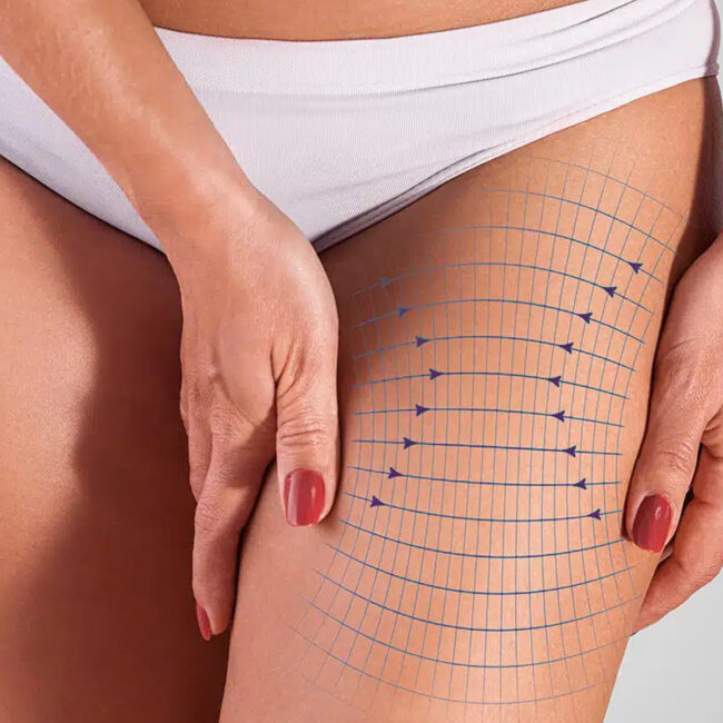 Hydurage advanced pdo threads aesthetics online training courses plaxpot skincare skin tightening rejuvenation beauty