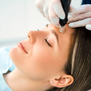 Microneedling Collagen Therapy Course