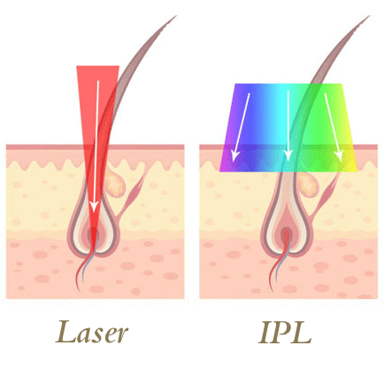 laser hair course