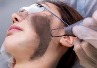 Carbon Laser Facial Course