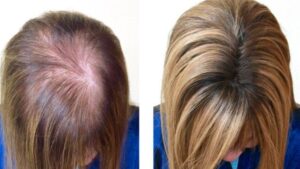 Hair Integration Replacement Course