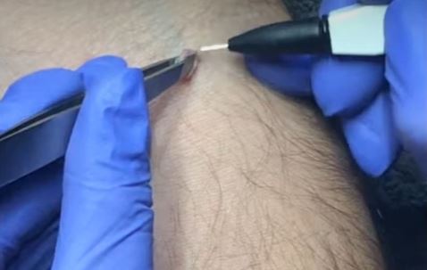 electrolysis course