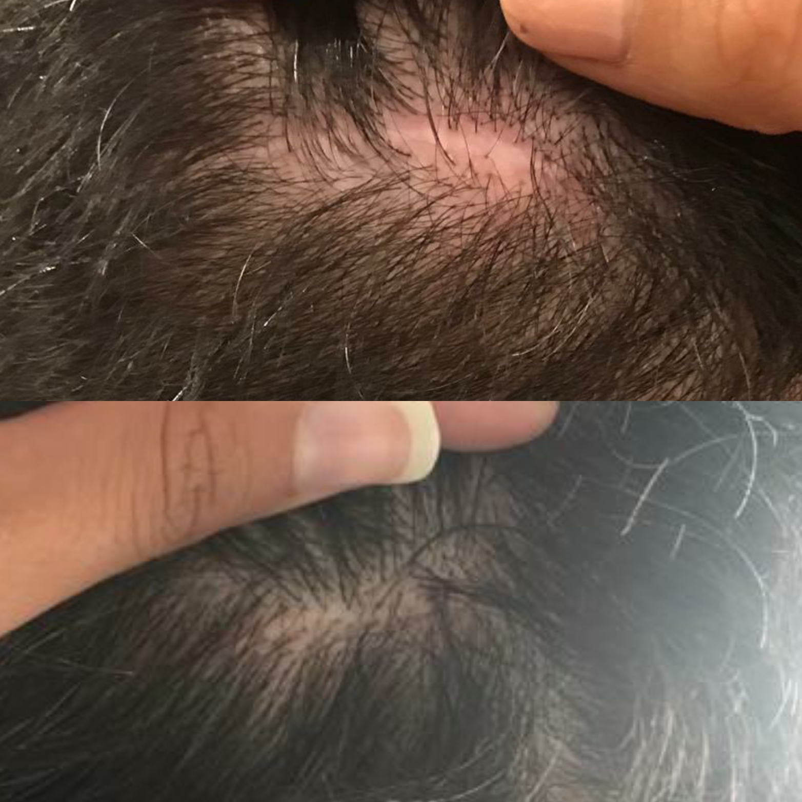 fusion plasma plasdual 14 warm cold hydurage aesthetics training courses machines devices lasers online beauty anti aging skin tightening