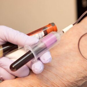 Read and Understand Blood Test Results (CBC)