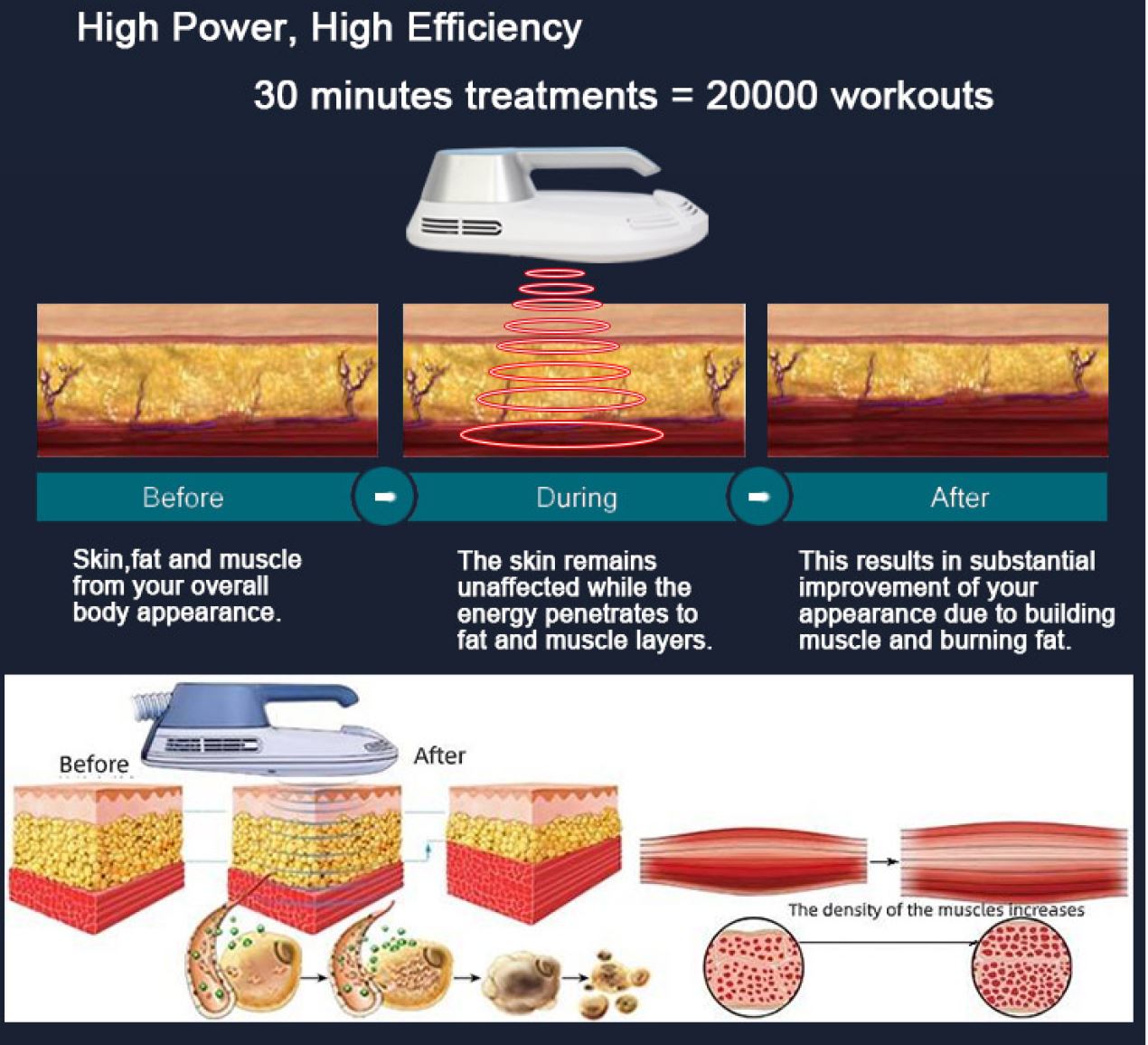 EMS facial machine hydurage aesthetics training courses machines devices lasers online beauty anti aging skin tightening