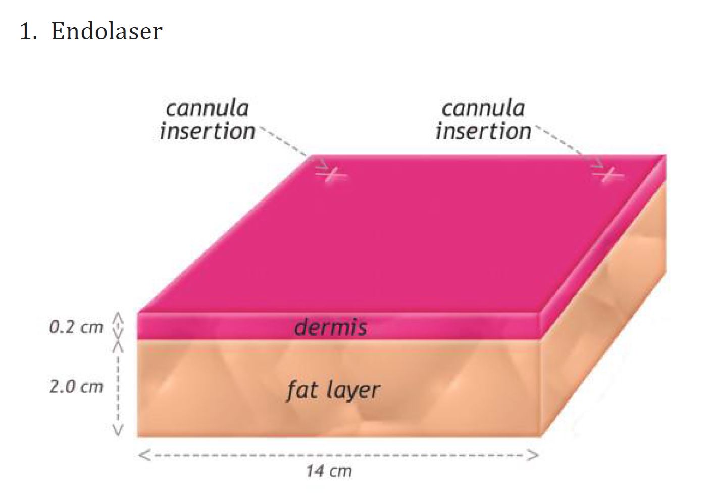 Hydurage FDA Endolifting Endolift Laser lipolysis machine device aesthetics online training courses plaxpot skincare skin tightening rejuvenation