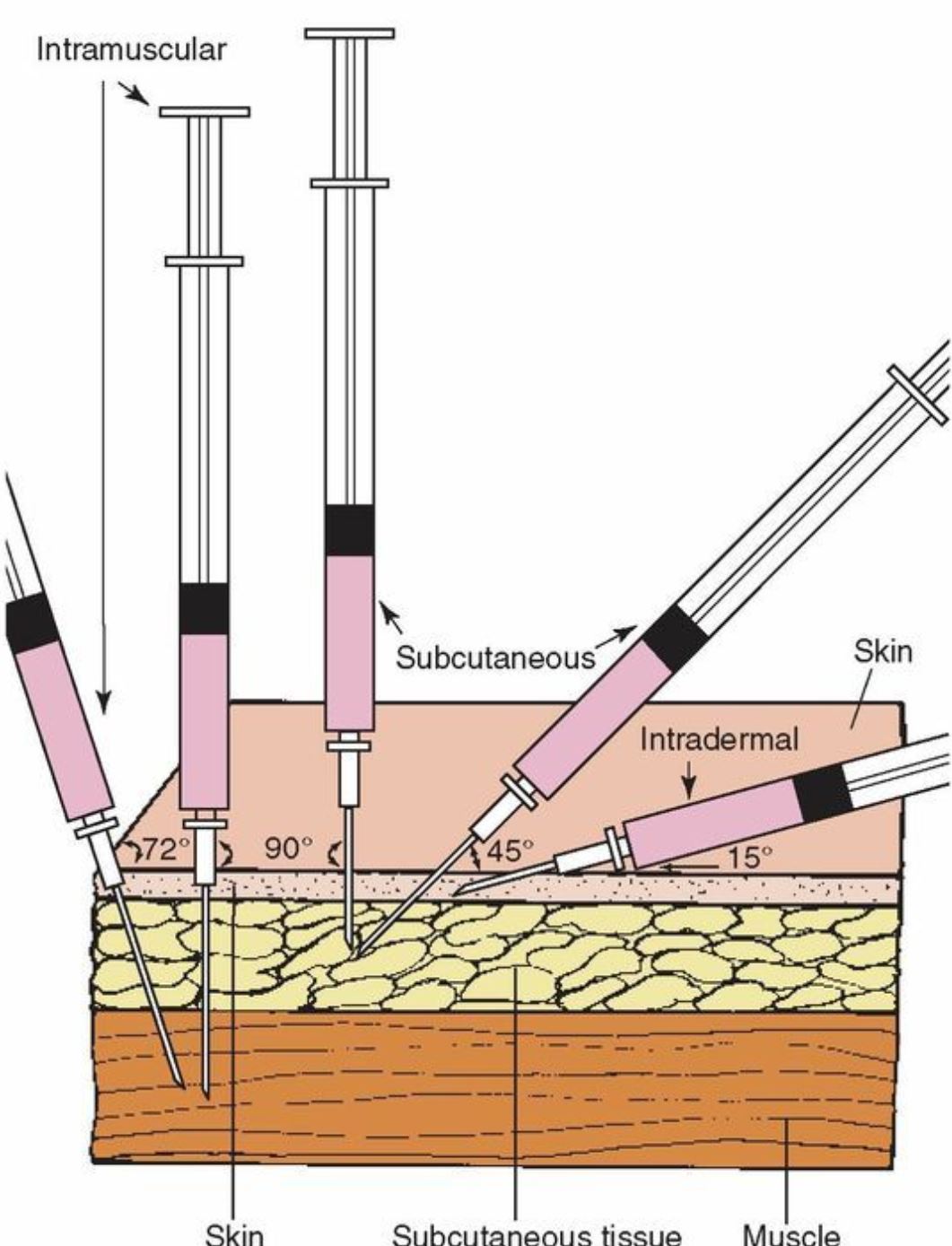 advanced dermal fillers hydurage aesthetics training courses machines devices lasers online beauty anti aging skin tightening