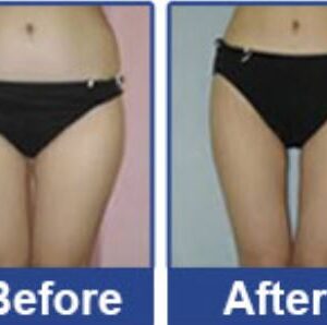 Laser lipo fat removal reduction hydurage aesthetics training courses machines devices lasers online beauty anti aging skin tightening