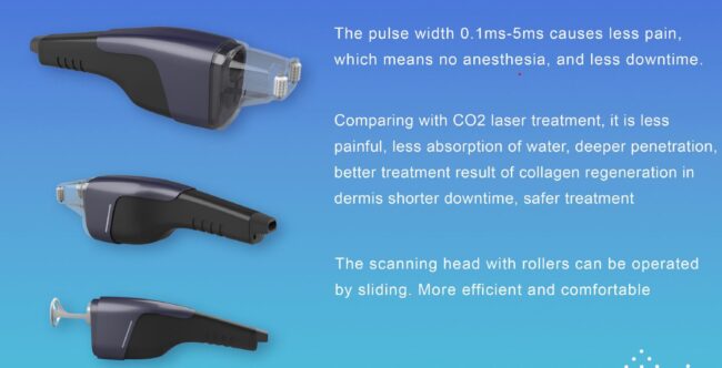 Thulium Laser FDA Approved - Image 2