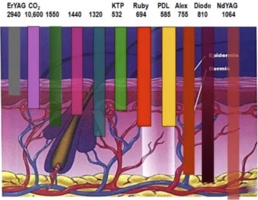 used in thulium laser course