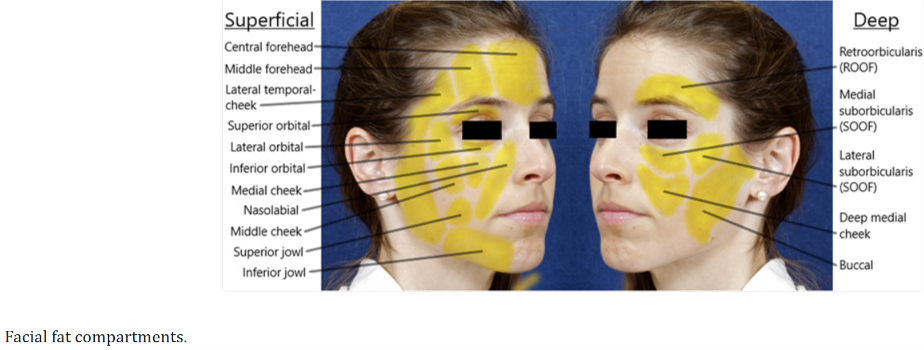 used in the advanced dermal fillers course